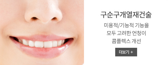 구순구개열재건술