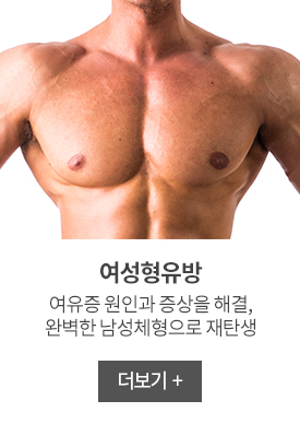 여성형유방